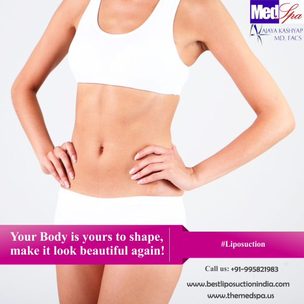 Liposuction for Removing Excess Fat and Getting sleek and Slim Body